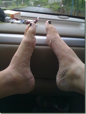 soggy feet