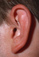 Ear (Image After) 2