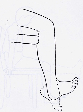 [Ankle-Foot[3].jpg]