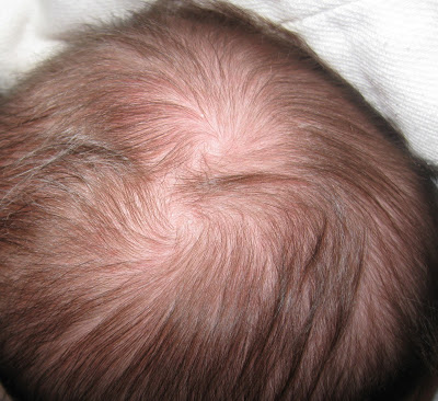 hair double whorls crown babycenter thoughts
