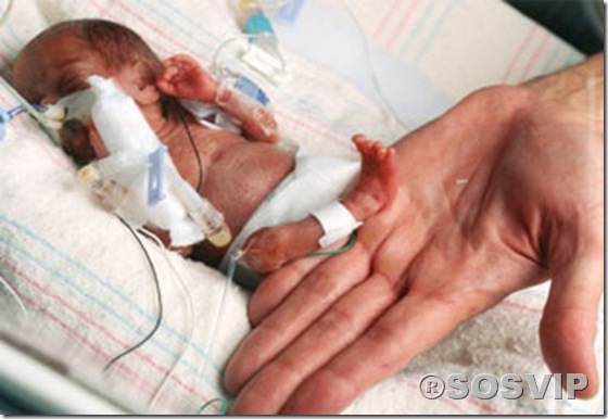 Bebês anormalidades anomalias.jpg (3)