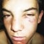 [Scholtz Arnold 16 beaten at NoordKaap High School Kimberley by pupils who steal food[6].jpg]
