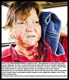 Myburgh Anna Jacoba 65 after her rescue from kidnap shooting 18Feb2010