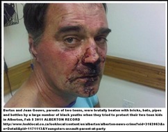 Gouws Berthus brutally beaten by black youths ALBERTON Feb112011