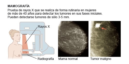 [mamografia2[6].jpg]