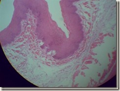 Stratified squamous epithelium under microscope_thumb