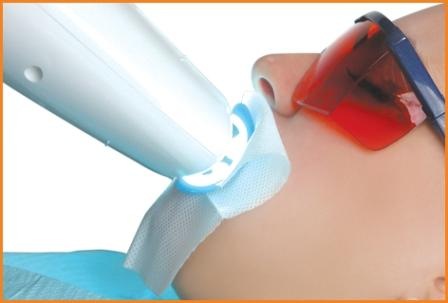 preço clareamento dental preço clareamento dental