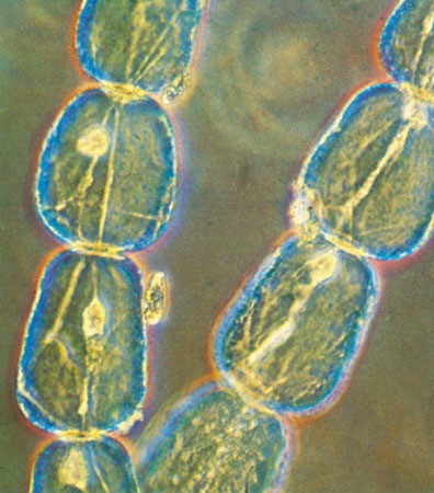 [condrioma[4].jpg]