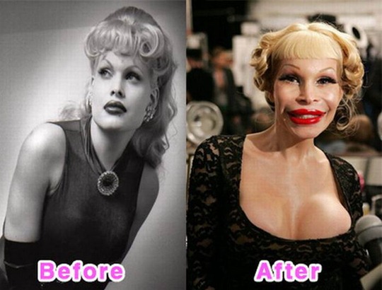 [celebrity_plastic_surgery_01[3].jpg]