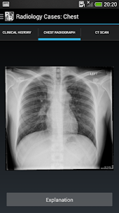 免費下載醫療APP|Radiology Cases: Chest app開箱文|APP開箱王