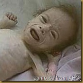 Romanian Orphan in crib, crying (orfan roman in patuc)