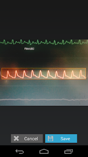 How to download Capstesia App Anesthesia 1.1.6 mod apk for pc