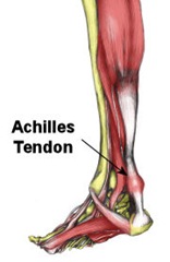 180achilles_inflammation