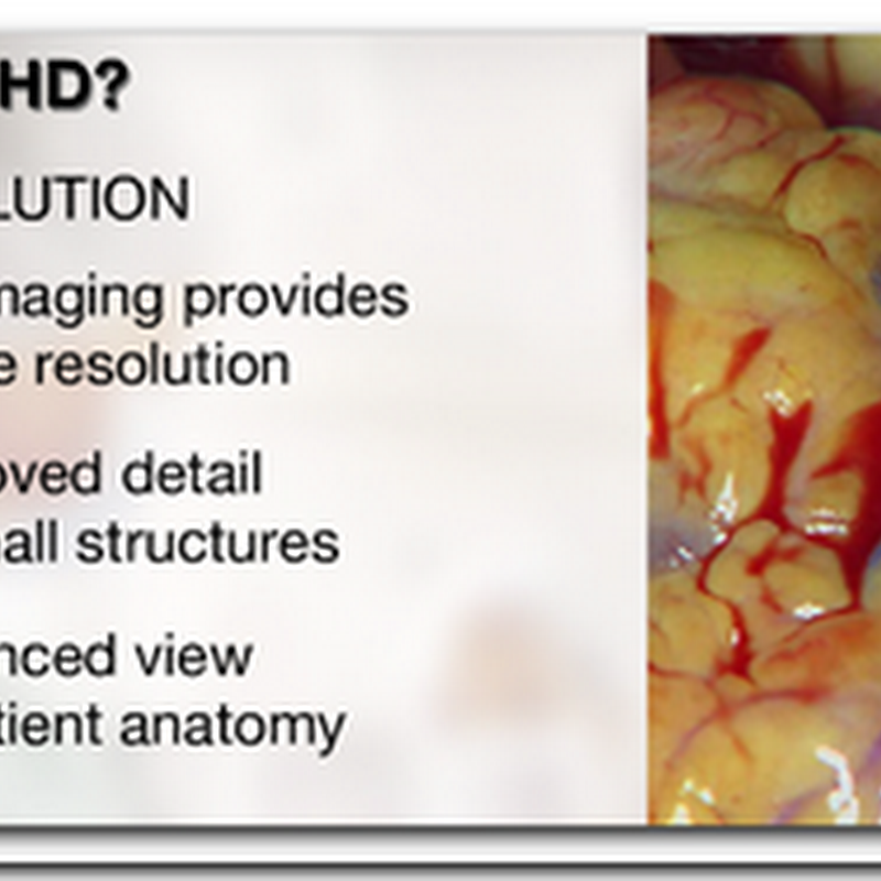 High Definition Surgery from Sony with four new products