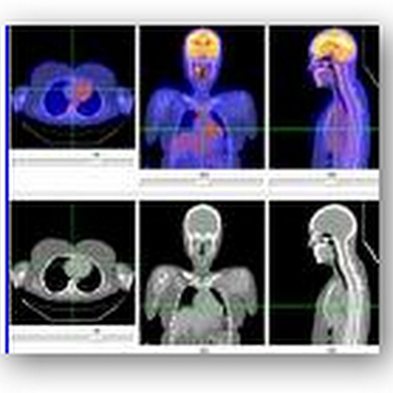 Evidence Based e-Ordering Coalition Formed to Promote Solutions for Appropriate Diagnostic Tests