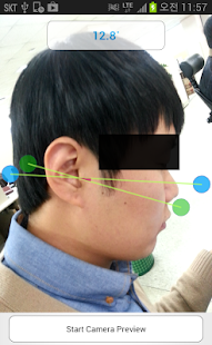 Smart Facebow(圖2)-速報App