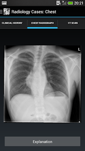 Radiology Cases: Chest(圖3)-速報App