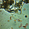 Arcyria ferruginea - spores