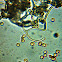 Arcyria ferruginea - spores