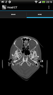 RadRevision: Anatomy on CT(圖3)-速報App