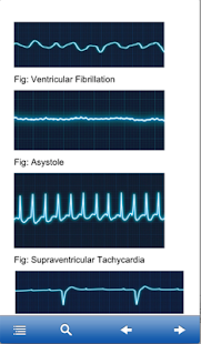 ACLS MegaCodes Review 2015(圖6)-速報App