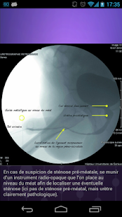 100% Urologie Screenshots 3