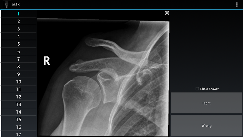 Radiology Flashcards: MSK Screen 3