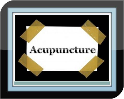 Acupuncture For Migraines
