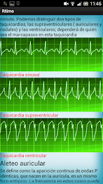 Electrocardiograma poster 6