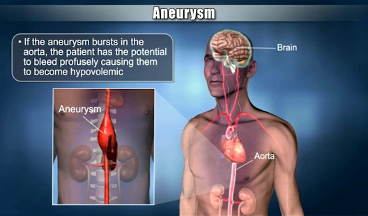 Download Medrills: Cardiac Emergencies APK