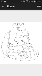 PICUDoctor 5 - Cardiac Guide(圖6)-速報App