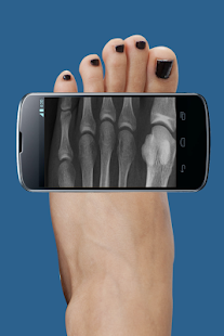 How to install Xray Scan Prank 1.7 apk for bluestacks
