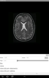 LEADTOOLS DICOM Viewer App(圖4)-速報App