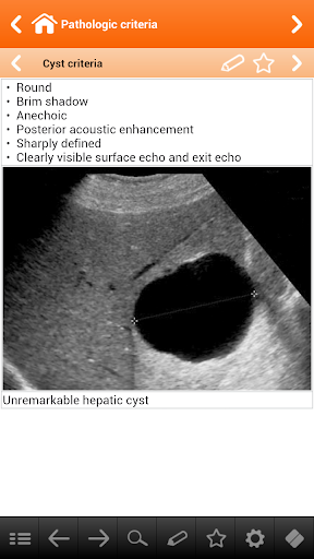 【免費醫療App】Abdominal Ultrasound pc-APP點子