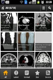 How to mod RadGray 2.0 mod apk for pc