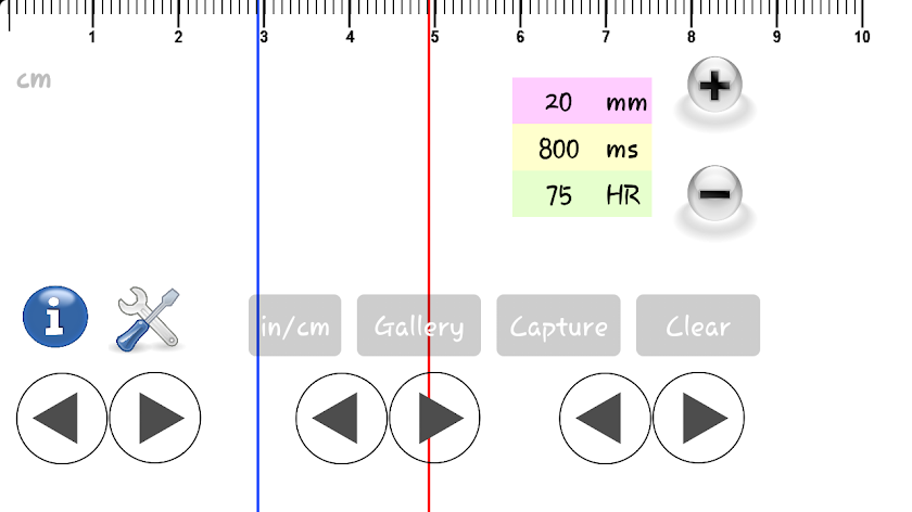 ECG Caliper Screen 3
