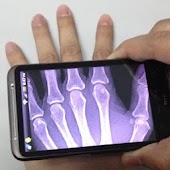 Xray Scan
