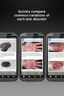 Dermatology DDx(圖3)-速報App