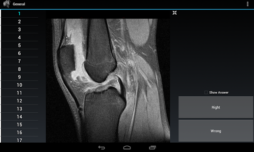 Radiology Flashcards: General