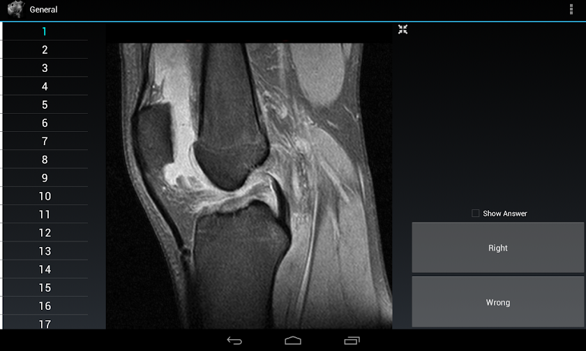 Radiology Flashcards: General Screen 3