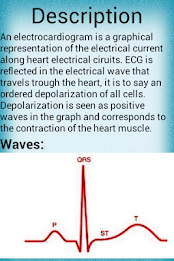 Electrocardiogram poster 2
