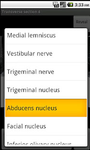 NeuroSlice(圖3)-速報App