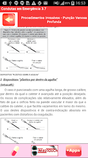 CONDUTAS EM EMERGÊNCIA(圖2)-速報App