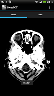 RadRevision: Anatomy on CT(圖5)-速報App