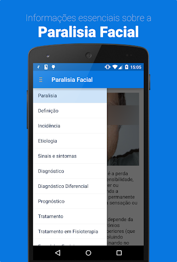 Paralisia Facial