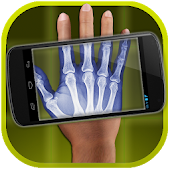 Xray Scanner PRO