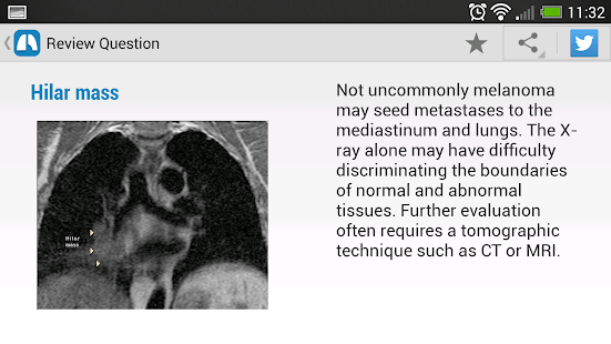 Chest X-Ray Training(圖7)-速報App