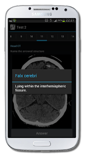 Radiological Anatomy For FRCR1(圖3)-速報App
