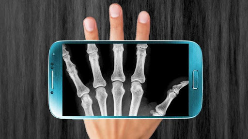 Xray Hand Scanner Prank