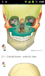 Craniotomy Screen 3
